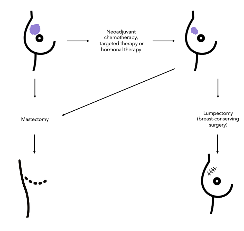 Neoadjuvant Chemotherapy