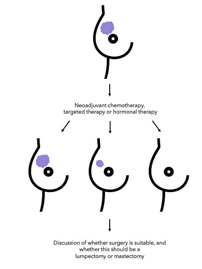 Chemotherapy for Breast Cancer