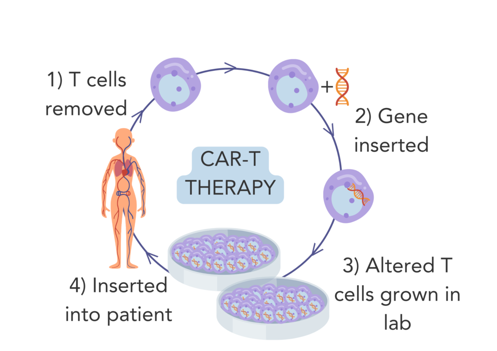 CAR-T immunotherapy for breast cancer